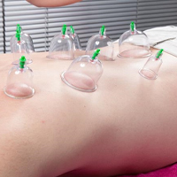 فواید کاپینگ تراپی یا بادکش درمانی چیست؟