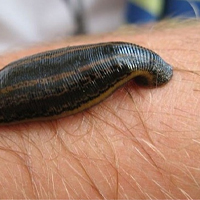 زالو درمانی چیست؟