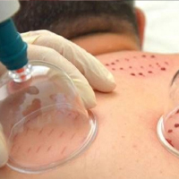 حجامت و فصد دکتر محمدرضا کریمی فرزقی